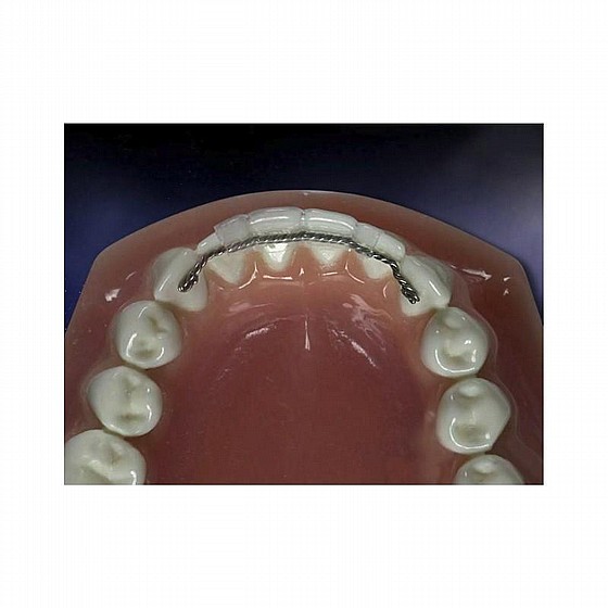 ��� ����� ���������� ������ ���� Morelli Orthodontic Wire Twist Flex