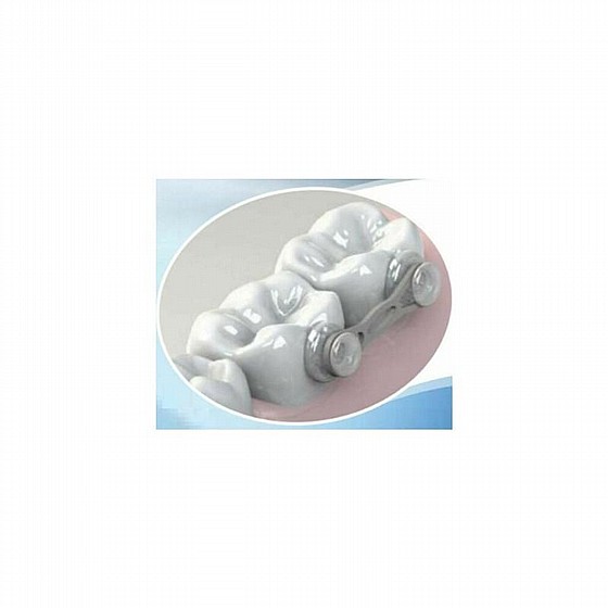 ����� ����� ���� �����  Morelli Orthodontic Dental Transparent Composite Lingual Buttons Aesthetic Treatment
