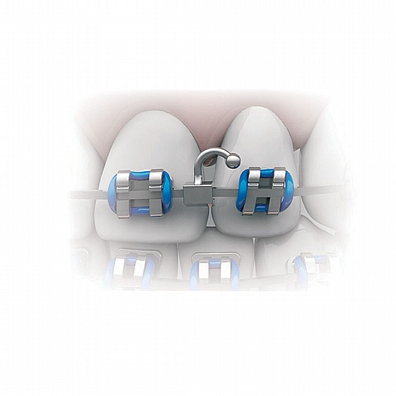 ���� ����������� ������� �� ���� ����� Dental Orthodontic Crimpable Split Hooks Right Special Curved Ball Tip 