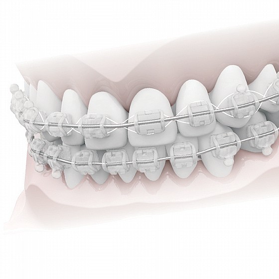 ��� ����������� ����� ��� ����� Morelli Aesthetic Orthodontic Ligature Wires CrNi