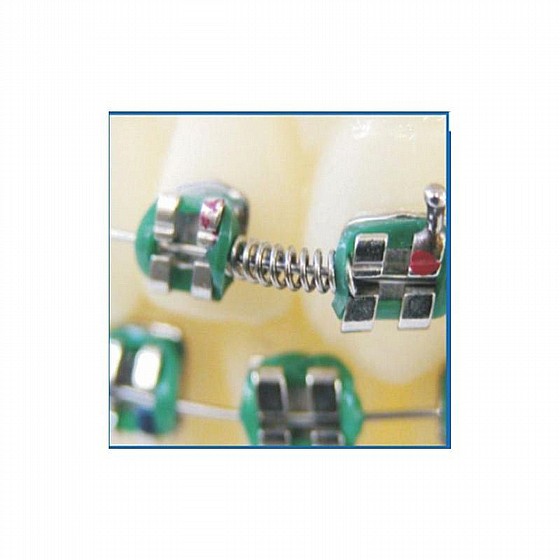 ���� ���� ���� ���������� NITI ����� Morelli Open Coil Orthodontic Spring