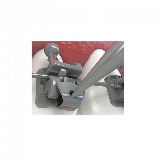 �� ������ ����� Morelli Self Ligating Brackets SLI Kit