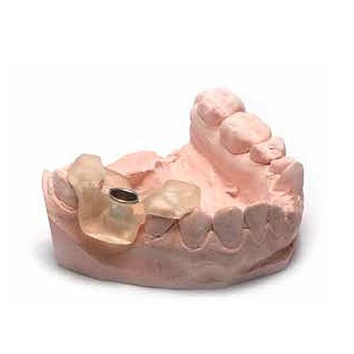 ��� ������ �� ������� ������ ��� ���� DSI 3D Resin Material For Surgical Guide LCD & DLP Printer 