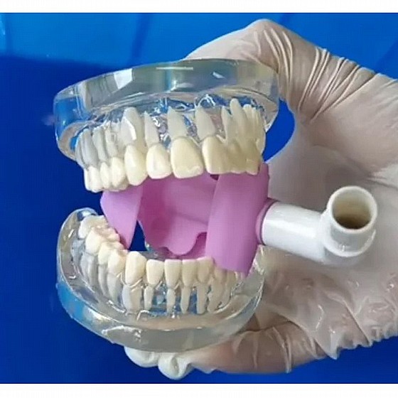 ����� ���� �� ���� ���� ������ Easyinsmile Suction Shield 