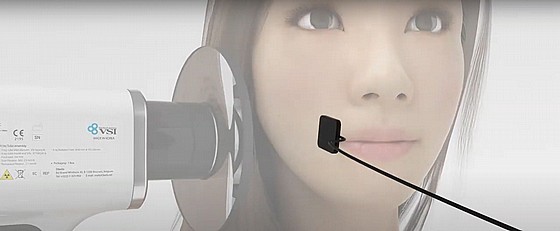����� ��� ����� ����� ���������� ������� ����� Intra-oral X-Ray Imaging Pluto Sensor