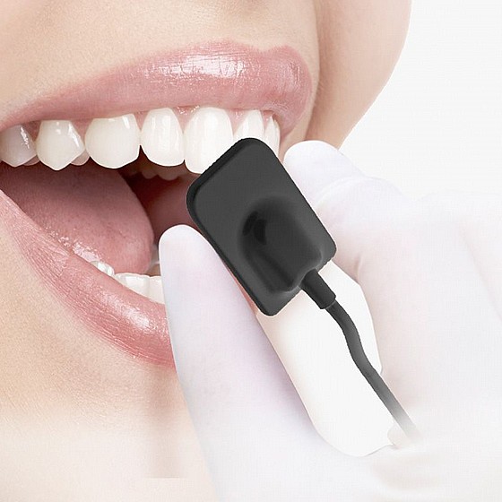 ����� ��� ����� ����� ���������� ������� ����� Intra-oral X-Ray Imaging Pluto Sensor