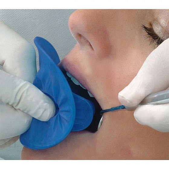���� �� �� ��� ���� ����� Disposable Lip Retractor And Dental Dam