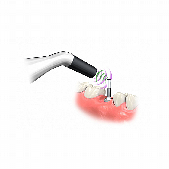 ������ ���������� Alpha-Bio / Zimmer / Camlog ���� ������ ������ ������ ���� Penguin II