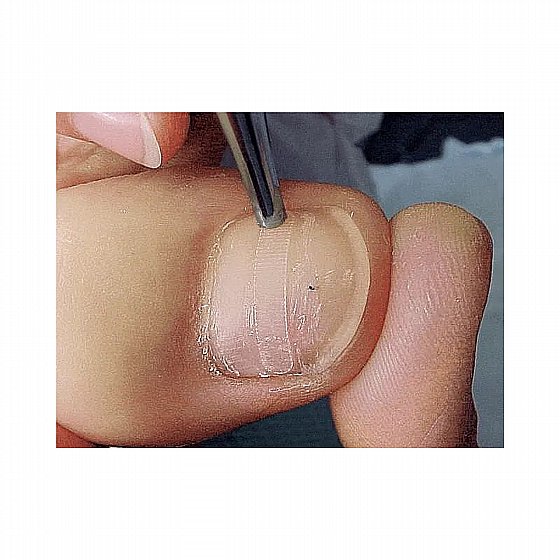 ������ ������� ������ �� ������ ������� 10�� ������ <br> BS-???????? ??? ??????? ?????? <br> RUCK B/S Brace