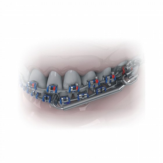 ��� ���� ����� ������ ������ ������������ 330�"� ���� ������ Morelli Telescopic Tube For Wires