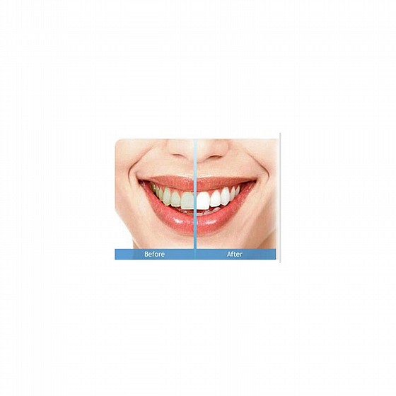 ���� ������ �� ������ ����� 300 ��� DSI PROPHY AIR PROPHYLAXIS POWDER FOR JET