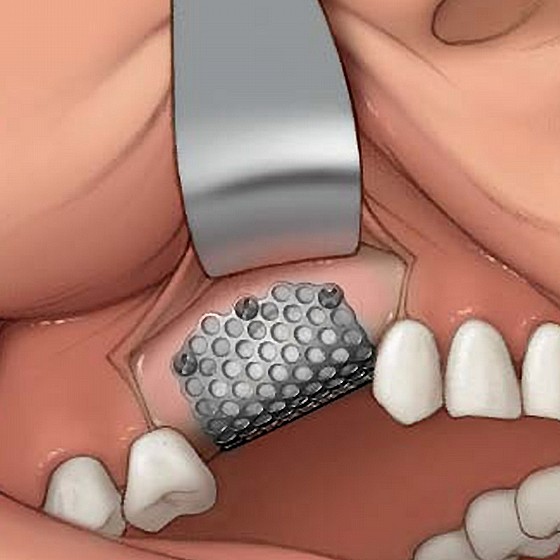 ���� ���� ����� ���� ������� ��.��.�� DSI GBR SELF-TAPPING SCREW