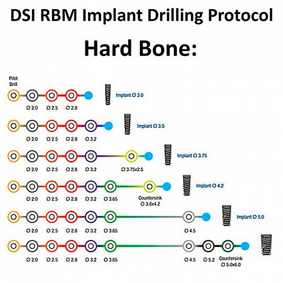 ��� ������ ��.��.�� DSI PREMIUM SPIRAL RBM IMPLANT