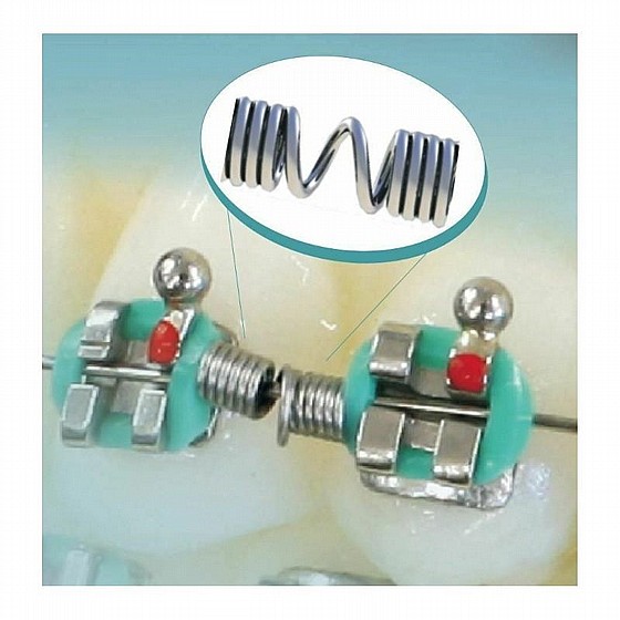 ���� ����� ���� ���� ������ ������� 3 �� 178 �"� Morelli Orthodontic Open & Closed NiTi Spring