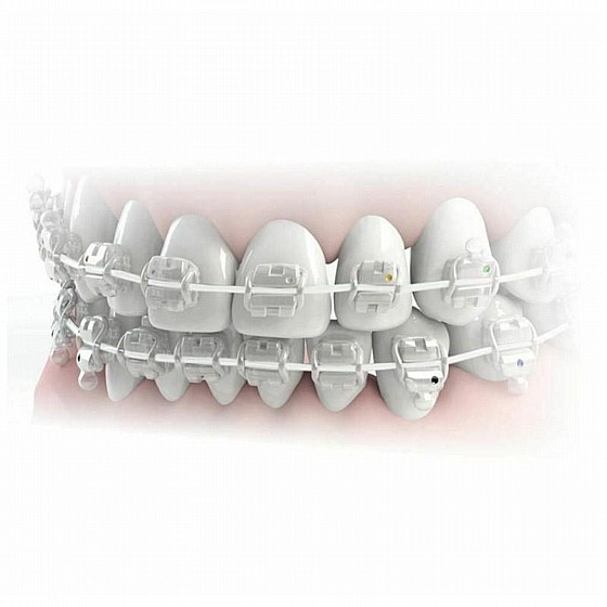 ���� ����� ��� ���� ������ ����� ���� ����� 5 �� Morelli Aesthetic Super Elastic Archwire NiTi Round