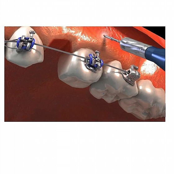 ���� ������ ������-��� ���������� Morelli Spear Tip Point Drill
