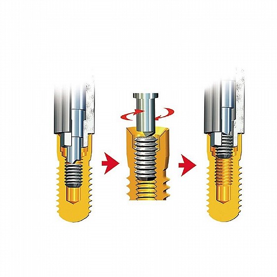 ���� ����� ���� ���� ���� Rhein83 Broken Screw Extractor Kit