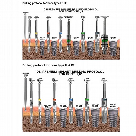 ���� ��� (���������) ���� DSI Implant Socket Standard Cylindrical Drill 