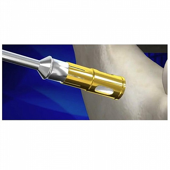 ���� ������ ������ ��� DSI Never Loss Bone Collector Drill Kit 