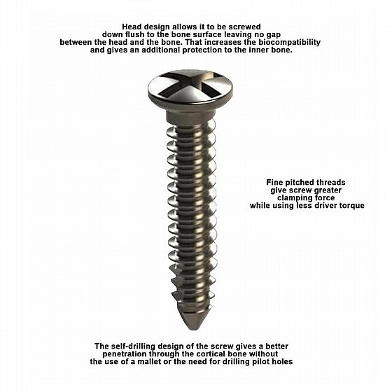 ���� GBR ������� ������ ������ DSI Bone Tenting Screw Full Thread
