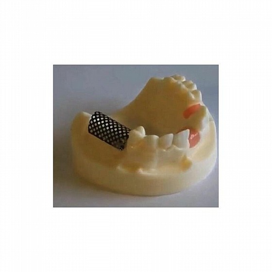 ���� GBR ������� ������ ������ DSI Bone Tenting Screw Half Thread
