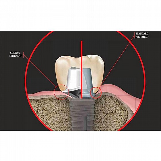 ���� ���/��� DSI CAD/CAM Ti-Custom Premill Abutment Titanium Blank