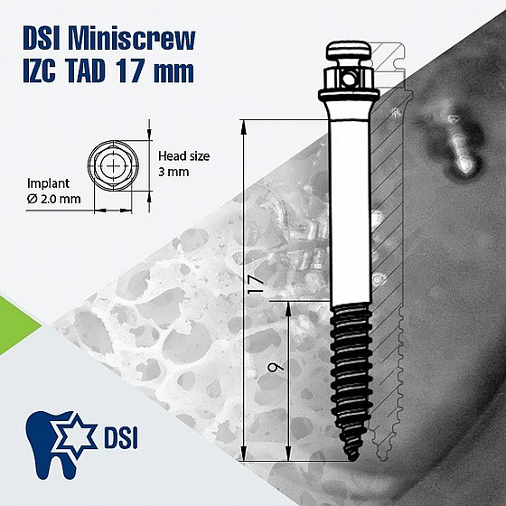 ����-���� ���������� DSI Orthodontic Bone Mini Screw Zygomatic TAD IZC L17mm ?2mm