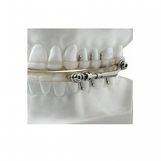 ����� Dentaurum Orthodontic Herbst II