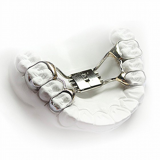 ���� ����� ���� ����  ������ RPE Morelli Palatal Expansion Screw