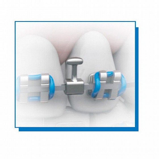 ���� ����� ����� 10�� Morelli Crimpable split Hooks Straight