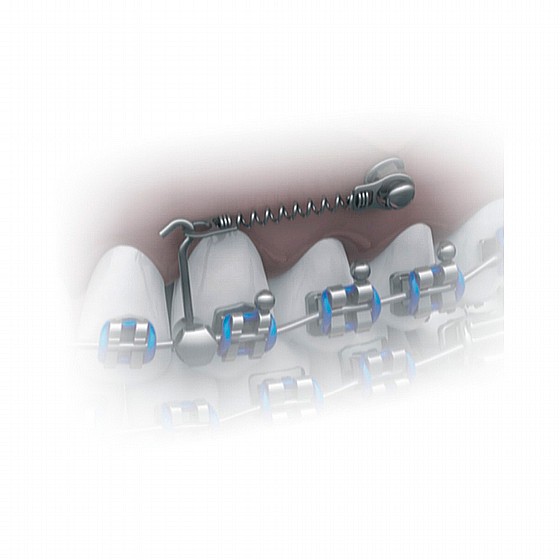 ���� ����� ���� � TAD / GURIN ������ 10�� ������  Morelli NiTi Closed Coil Spring w/eyelets 1.60/2.30mm