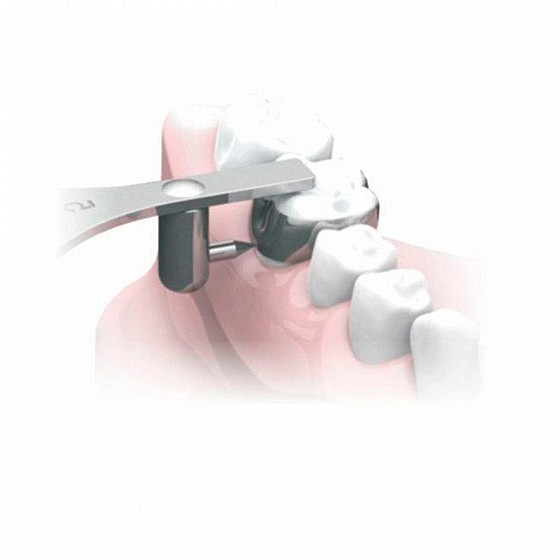��� ������ ����� ������ ���� �� ����� Morelli Boone Gauge Orthodontic Bracket Positioner Star