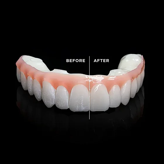 ���� ����� ��������� ������� 5 �"� ��� ���� �- N2 PacDent Rodin� Glaze N2-Free