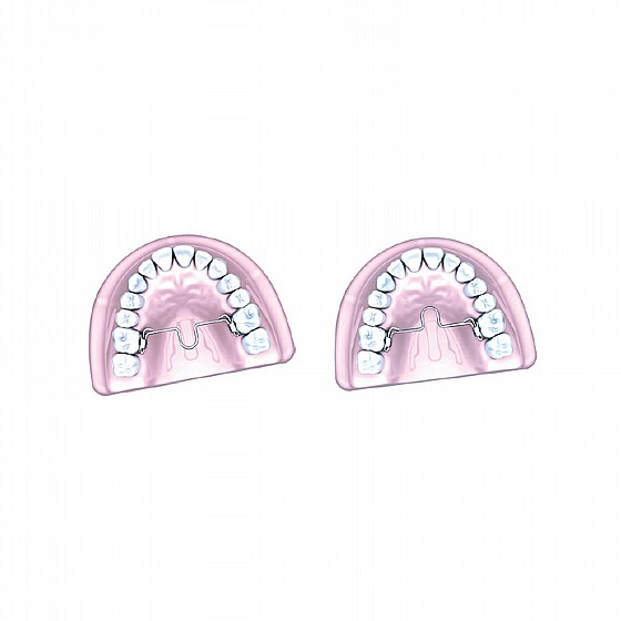 ���� ����������� �� ����� �� ����� Morelli Orthodontic Palatal Bar With Mesial/Distal Loop