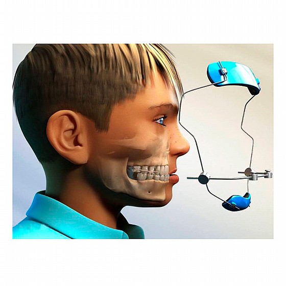 ���� ����� ���� ����������� Orthoquest Orthodontic Protraction Mask Reverse Pull Headgear 