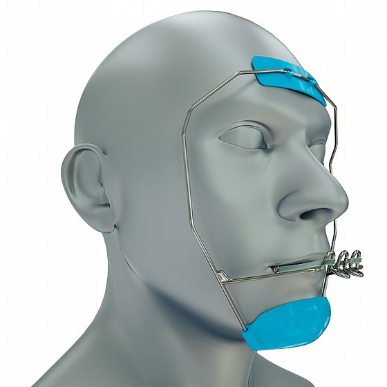 ���  ���� ����� ���� ����������� Great Lakes Orthodontics Mask Reverse Pull Headgear