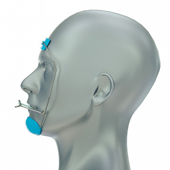 ���  ���� ����� ���� ����������� Great Lakes Orthodontics Mask Reverse Pull Headgear