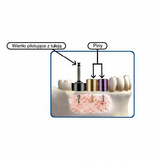 ��� ������ ������ ����� ��� ��� �� ������� IMPLANT POSITIONING KIT