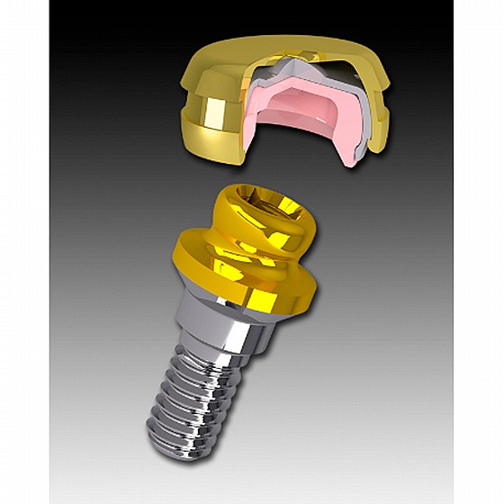 ��� ���� ��� ���� ������ Rhein83 Lock Attachment OT Smartbox Housing Cap