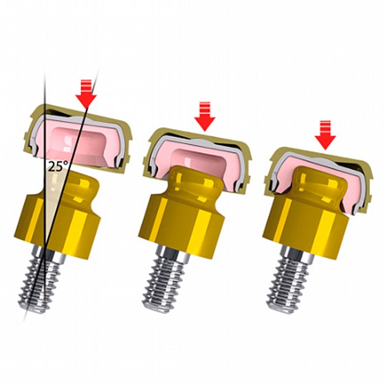 ��� ���� ��� ���� ������ Rhein83 Lock Attachment OT Smartbox Housing Cap