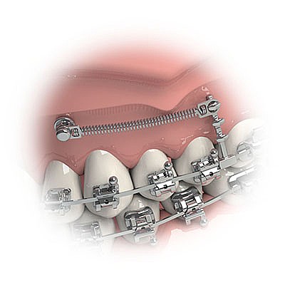 �� �� ������ ������ ������������ Morelli Universal Hook For TAD