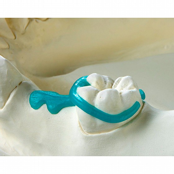 ������ ������ ������ ���� 200�� Renfert GEO Preformed Clasps