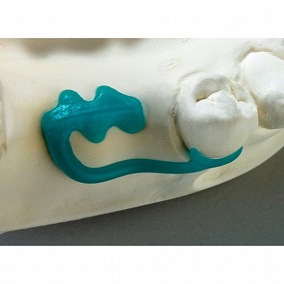 ������ ������ ������ ���� 200�� Renfert GEO Preformed Clasps