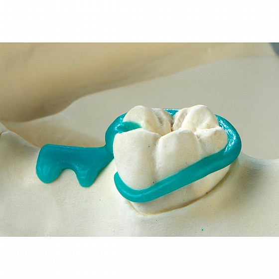������ ������ ������ ���� 200�� Renfert GEO Preformed Clasps