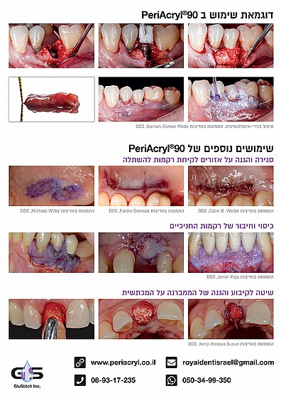 ��� ������� ������ �� ������ ������ �� �� 9 �� ���� ����� ������ Periacryl 90 HV