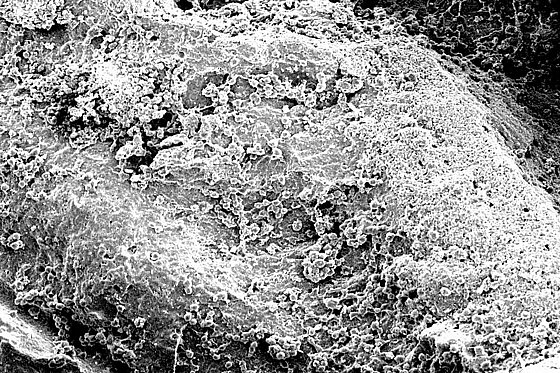 ���� ������ ��� ����� ��� ���� ����� ���� ������ Botiss Biomaterials Cerabone� 100% Pure Bone Mineral of Bovine 