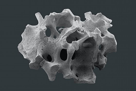 ���� ������ ��� ����� ��� ���� ����� ���� ������ Botiss Biomaterials Cerabone� 100% Pure Bone Mineral of Bovine 