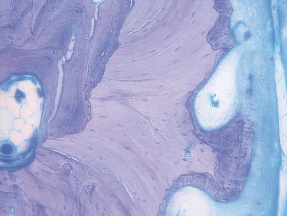 ������ ��� ����� ����� �������-������ ����� X ��� ������ Botiss Biomaterials Maxgraft� Granules Substitute from Human Bone