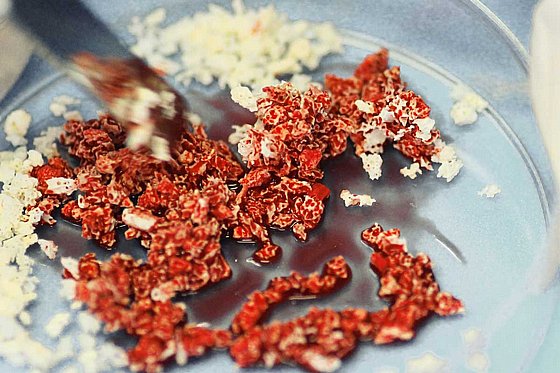 ������ ��� ����� ����� �������-������ ����� X ��� ������ Botiss Biomaterials Maxgraft� Granules Substitute from Human Bone
