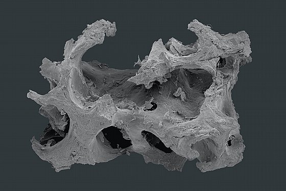 ������ ��� ����� ����� �������-������ ����� X ��� ������ Botiss Biomaterials Maxgraft� Granules Substitute from Human Bone